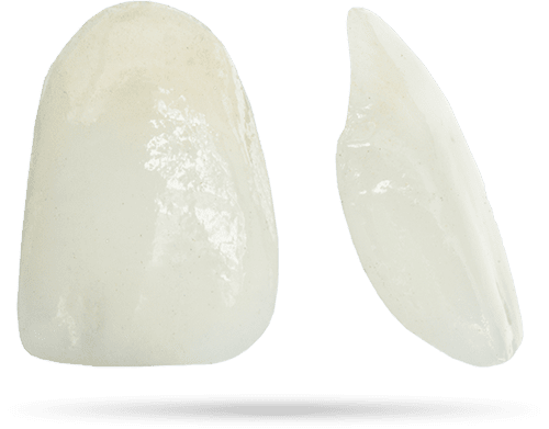 dental-veneers